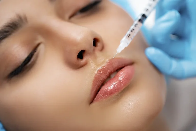 Cirurgia Plástica Facial - Aumento Definitivo do Lábio Superior